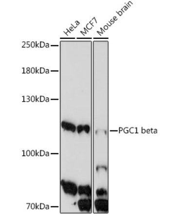 PGC1 beta Rabbit Polyclonal Antibody