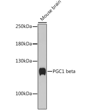 PGC1 beta Rabbit Polyclonal Antibody
