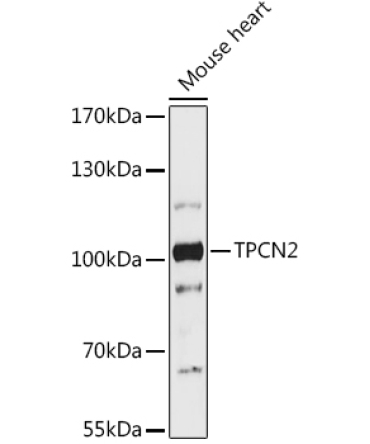 TPCN2 Rabbit Polyclonal Antibody