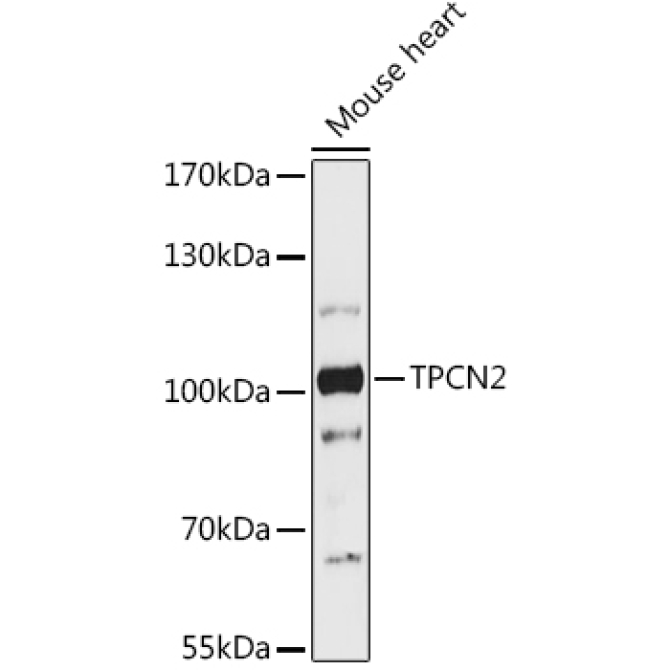 TPCN2 Rabbit Polyclonal Antibody