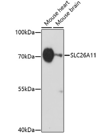 SLC26A11 Rabbit Polyclonal Antibody