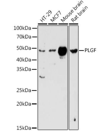 PLGF Rabbit Polyclonal Antibody