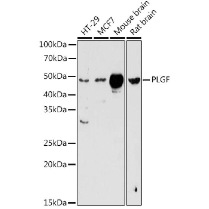 PLGF Rabbit Polyclonal Antibody