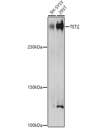 TET2 Rabbit Polyclonal Antibody