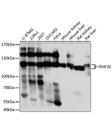 RNF20 Rabbit Polyclonal Antibody