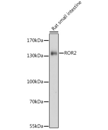ROR2 Rabbit Polyclonal Antibody