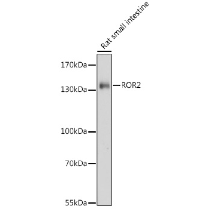 ROR2 Rabbit Polyclonal Antibody