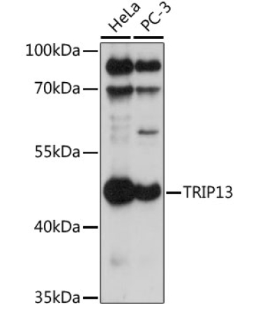TRIP13 Rabbit Polyclonal Antibody