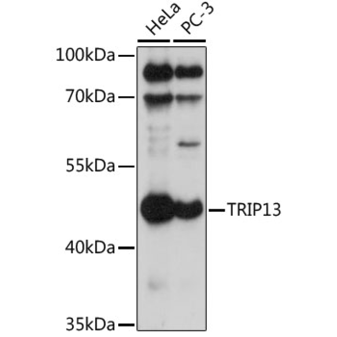 TRIP13 Rabbit Polyclonal Antibody