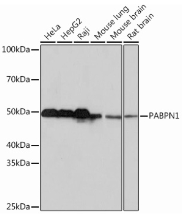 Polyclonal AntibodyPN1 Rabbit Monoclonal Antibody