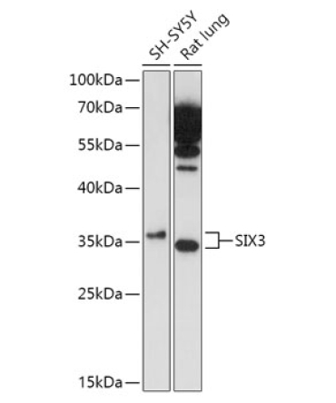 SIX3 Rabbit Polyclonal Antibody