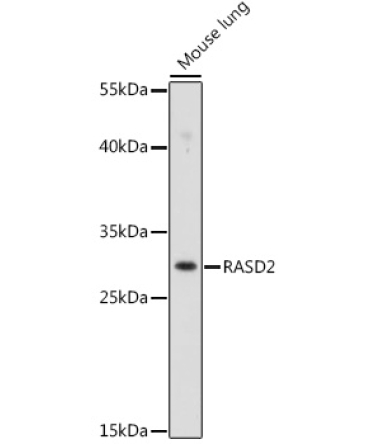 RASD2 Rabbit Polyclonal Antibody