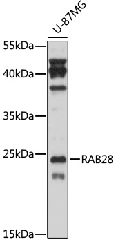 RAB28 Rabbit Polyclonal Antibody