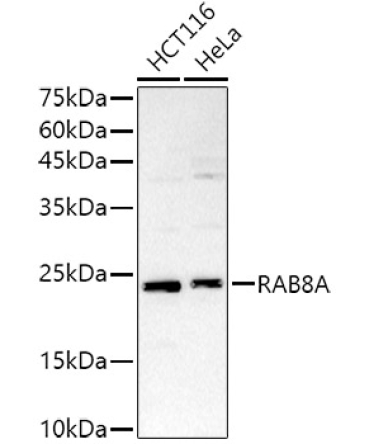 RAB8A Rabbit Polyclonal Antibody
