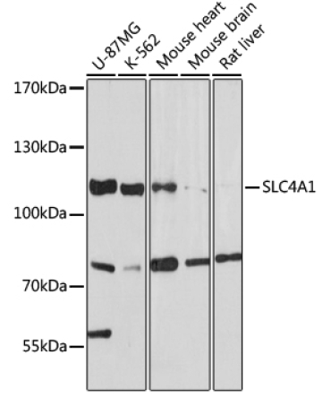 SLC4A1 Rabbit Polyclonal Antibody