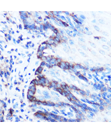 PDGFA Rabbit Polyclonal Antibody