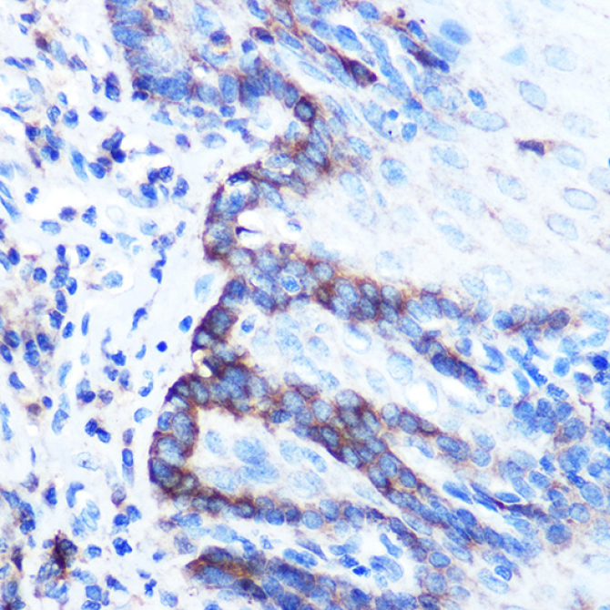 PDGFA Rabbit Polyclonal Antibody