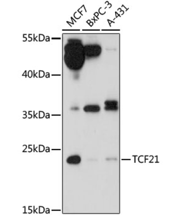 TCF21 Rabbit Polyclonal Antibody