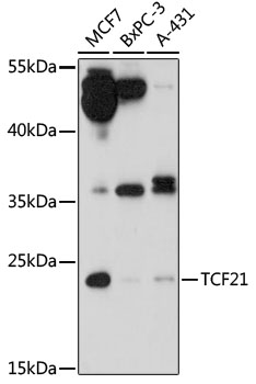 TCF21 Rabbit Polyclonal Antibody