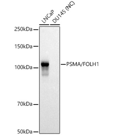 PSMA/FOLH1 Rabbit Polyclonal Antibody