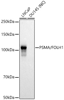 PSMA/FOLH1 Rabbit Polyclonal Antibody