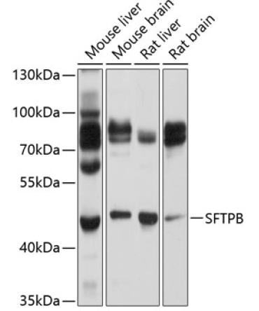 SFTPB Rabbit Polyclonal Antibody
