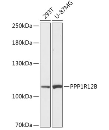 PPP1R12B Rabbit Polyclonal Antibody