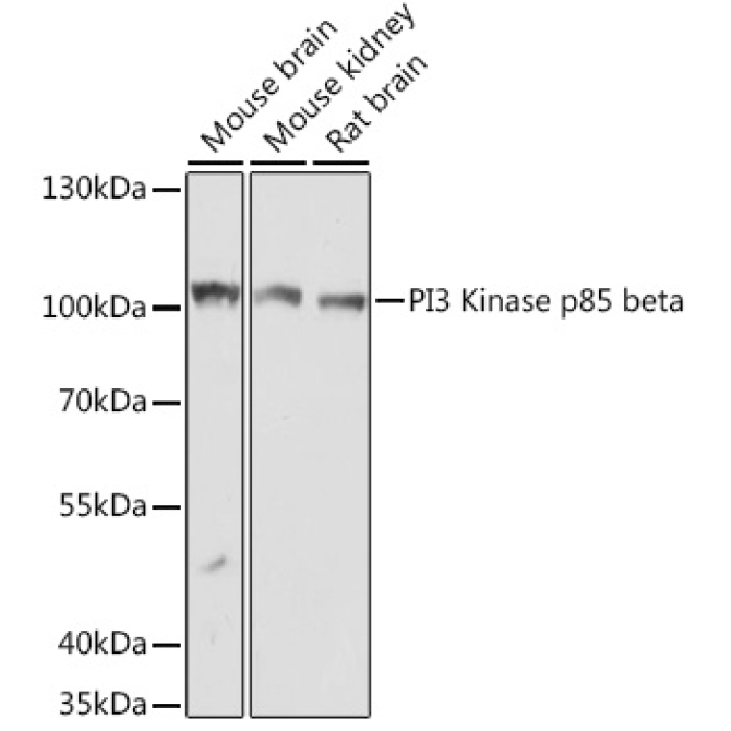 PI3 Kinase p85 beta Rabbit Polyclonal Antibody