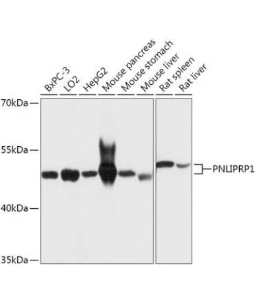 PNLIPRP1 Rabbit Polyclonal Antibody
