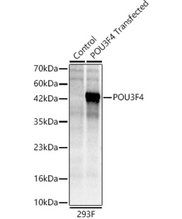 POU3F4 Rabbit Polyclonal Antibody