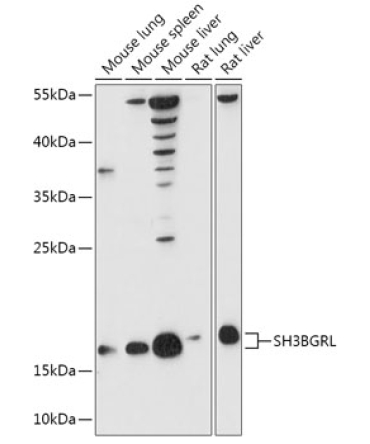 SH3BGRL Rabbit Polyclonal Antibody