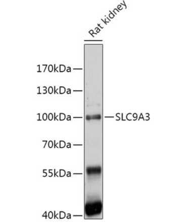 SLC9A3 Rabbit Polyclonal Antibody