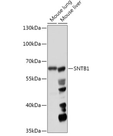 SNTB1 Rabbit Polyclonal Antibody