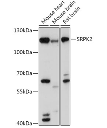 SRPK2 Rabbit Polyclonal Antibody