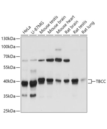 TBCC Rabbit Polyclonal Antibody