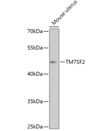 TM7SF2 Rabbit Polyclonal Antibody