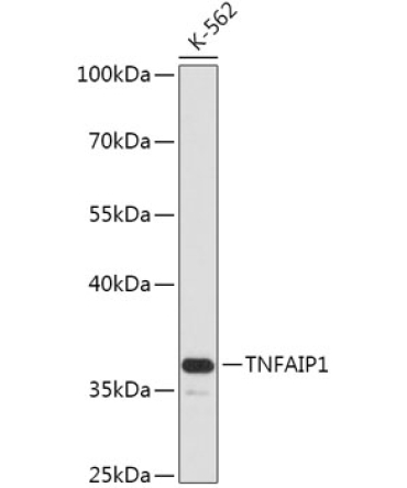 TNFAIP1 Rabbit Polyclonal Antibody