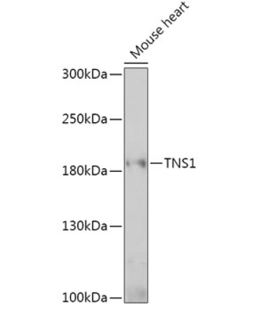 TNS1 Rabbit Polyclonal Antibody