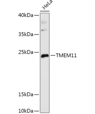 TMEM11 Rabbit Polyclonal Antibody