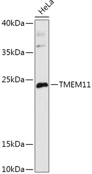TMEM11 Rabbit Polyclonal Antibody