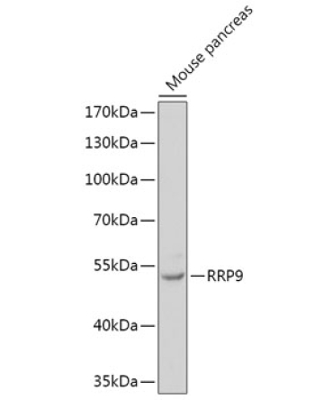 RRP9 Rabbit Polyclonal Antibody