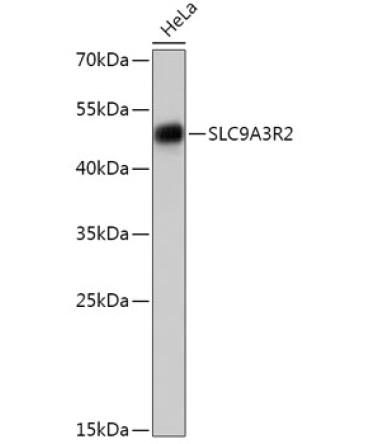 SLC9A3R2 Rabbit Polyclonal Antibody