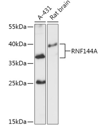 RNF144A Rabbit Polyclonal Antibody