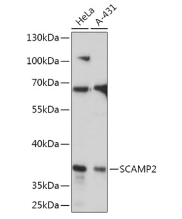 SCAMP2 Rabbit Polyclonal Antibody