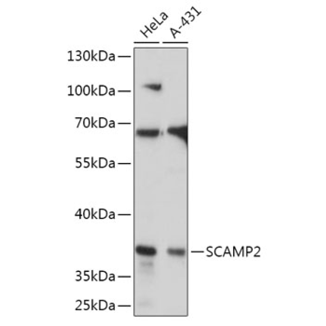 SCAMP2 Rabbit Polyclonal Antibody