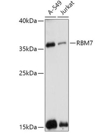 RBM7 Rabbit Polyclonal Antibody