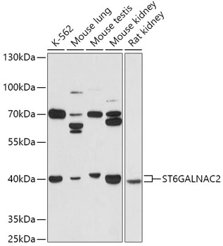 ST6GALNAC2 Rabbit Polyclonal Antibody