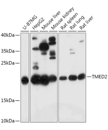 TMED2 Rabbit Polyclonal Antibody