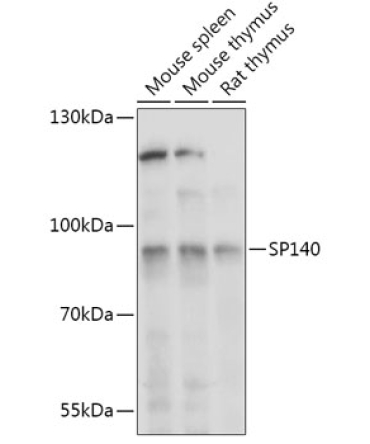 SP140 Rabbit Polyclonal Antibody