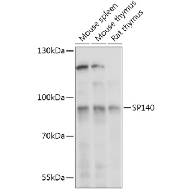 SP140 Rabbit Polyclonal Antibody